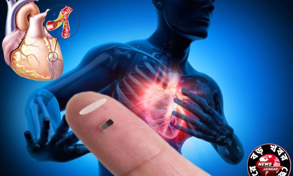 বিশ্বের সবচেয়ে ক্ষুদ্রাকৃতির পেসমেকার(চালের চেয়েও ছোট)!