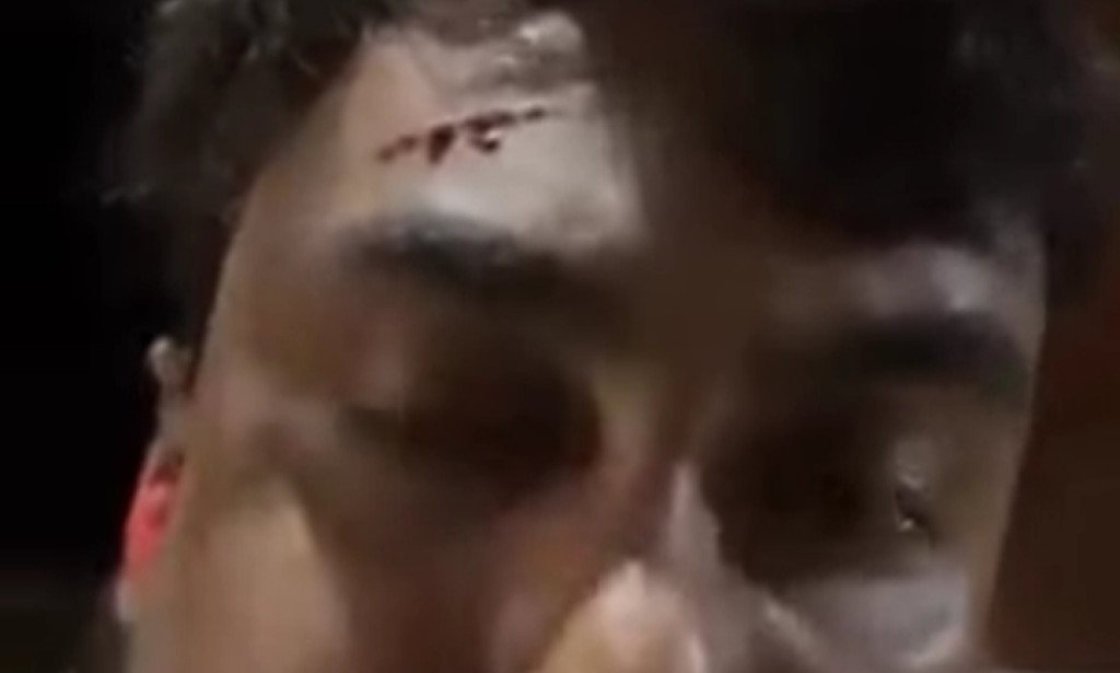 *রক্তাক্ত সংবাদ মাধ্যমের কর্মী কিশালয় মুখার্জি*